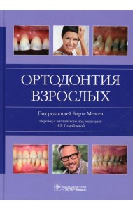 Ортодонтия взрослых