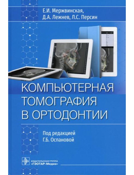 Компьютерная томография в ортодонтии