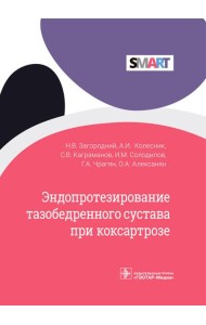Эндопротезирование тазобедренного сустава при коксартрозе