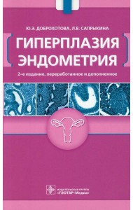 Гиперплазия эндометрия