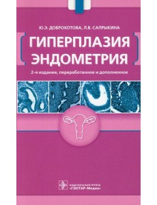 Гиперплазия эндометрия Гиперплазия эндометрия