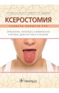 Ксеростомия. Сухость полости рта. Этиология, патогенез, клиническая картина, диагностика и лечение