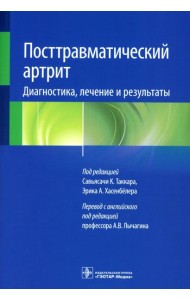 Посттравматический артрит. Диагностика, лечение и результаты