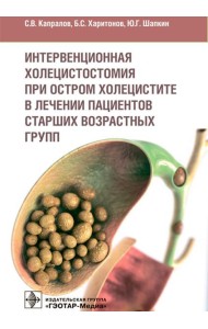 Интервенционная холецистостомия при остром холецистите в лечении пациентов старших возврастных групп