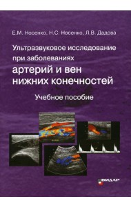 Ультразвуковое исследование при заболеваниях артерий и вен нижних конечностей: Учебное пособие