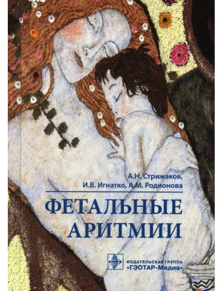 Фетальные аритмии