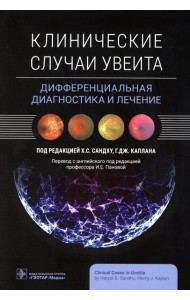 Клинические случаи увеита. Дифференциальная диагностика и лечение