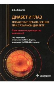 Диабет и глаз. Поражение органа зрения при сахарном диабете: практическое руководство для врачей