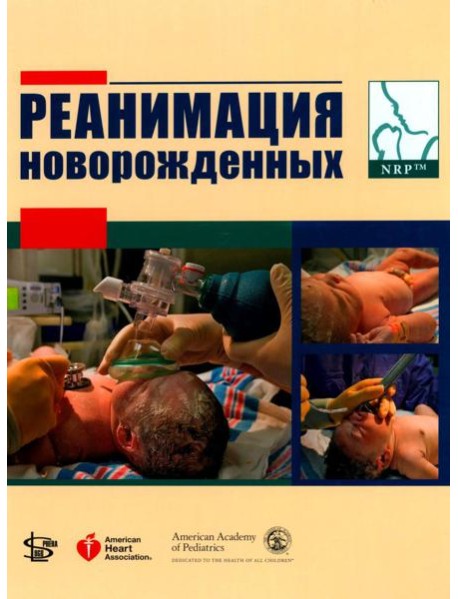 Реанимация новорожденных