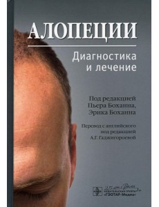 Алопеции. Диагностика и лечение Алопеции. Диагностика и лечение