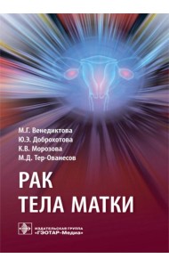 Рак тела матки