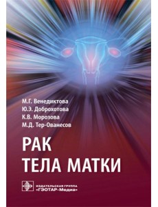 Рак тела матки Рак тела матки