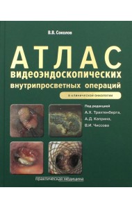 Атлас видеоэндоскопических внутрипросветных операций в клинической онкологии