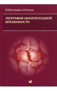 Эхография многоплодной беременности