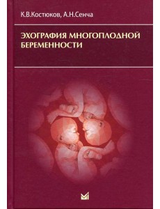 Эхография многоплодной беременности