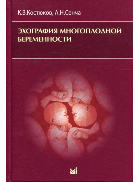 Эхография многоплодной беременности