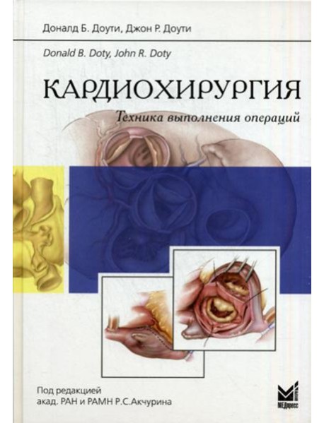 Кардиохирургия. Техника выполнения операций.