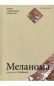 Меланома. Успехи современной онкологии