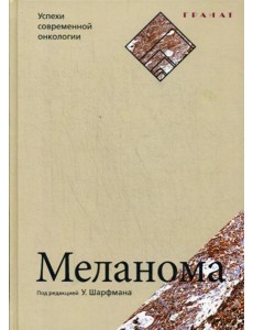 Меланома. Успехи современной онкологии