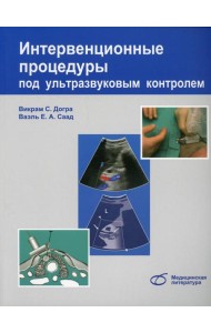 Интервенционные процедуры под ультразвуковым контролем