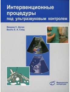 Интервенционные процедуры под ультразвуковым контролем Интервенционные процедуры под ультразвуковым контролем