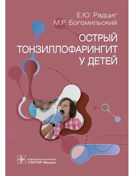 Острый тонзиллофарингит у детей