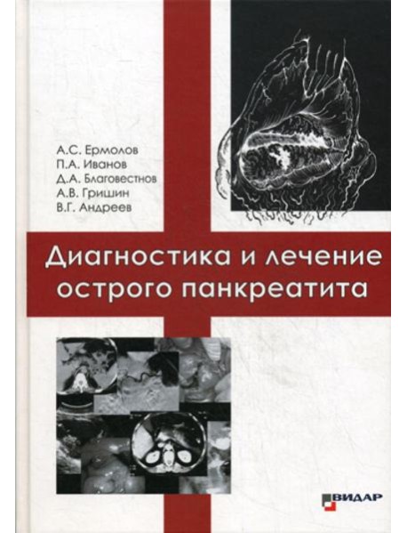 Диагностика и лечение острого панкреатита