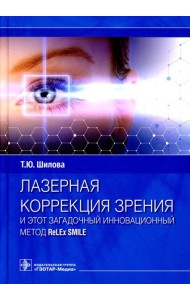 Лазерная коррекция зрения и этот загадочный инновационный метод ReLEx SMILE