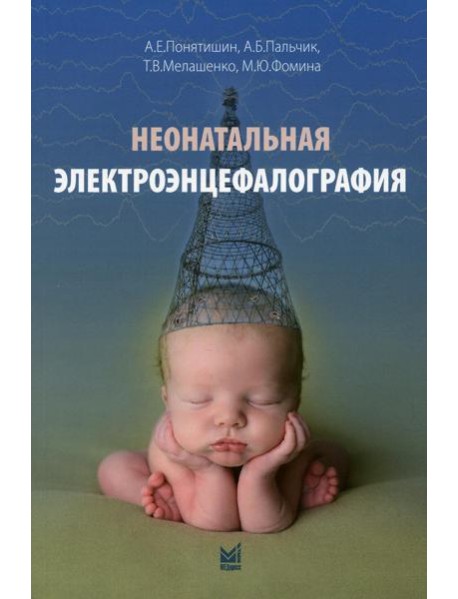 Неонатальная электроэнцефалография