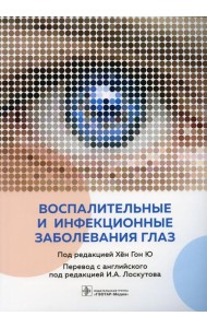 Воспалительные и инфекционные заболевания глаз