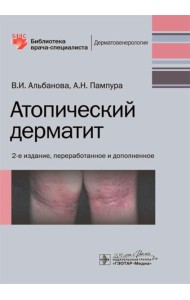 Атопический дерматит. 2-е изд., перераб. и доп