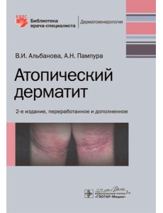 Атопический дерматит. 2-е изд., перераб. и доп