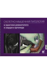 Скелетно-мышечная патология в практике ревматолога и хирурга-ортопеда: Краткое иллюстрированное руководство