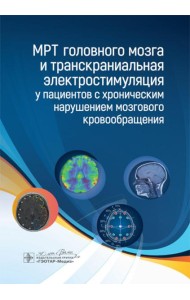 МРТ головного мозга и транскраниальная электростимуляция у пациентов с хроническим нарушением мозгового кровообращения