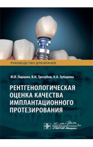 Рентгенологическая оценка качества имплантационного протезирования: руководство для врачей