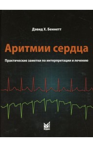 Аритмии сердца. Практические заметки по интерпретации и лечению
