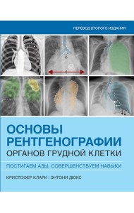 Основы рентгенографии органов грудной клетки