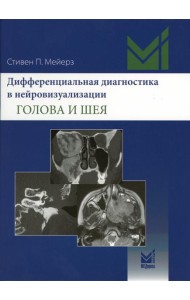 Дифференциальная диагностика в нейровизуализации. Голова и шея