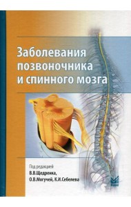 Заболевания позвоночника и спинного мозга.