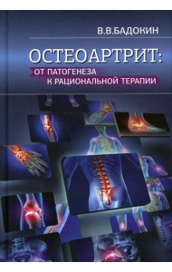 Остеоартрит: от патогенеза к рациональной терапии