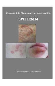 Эритемы. Руководство для врачей