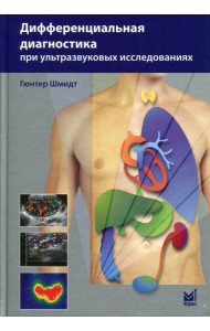 Дифференциальная диагностика при ультразвуковых исследованиях. 2-е изд