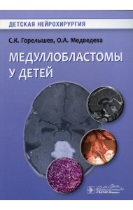 Медуллобластомы у детей