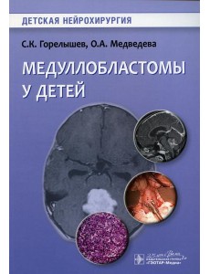 Медуллобластомы у детей Медуллобластомы у детей