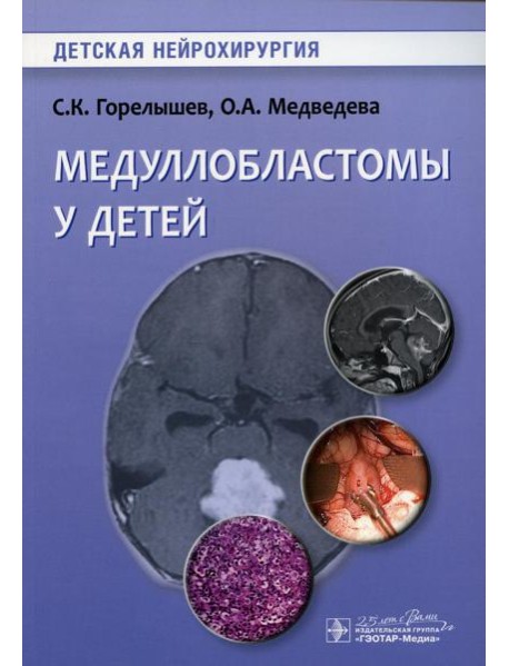 Медуллобластомы у детей