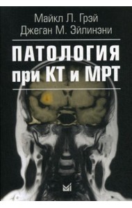 Патология при КТ и МРТ. 2-е изд