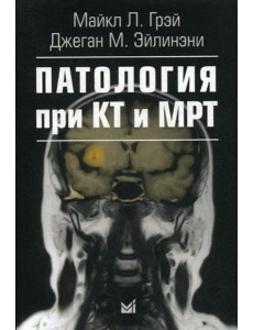 Патология при КТ и МРТ. 2-е изд