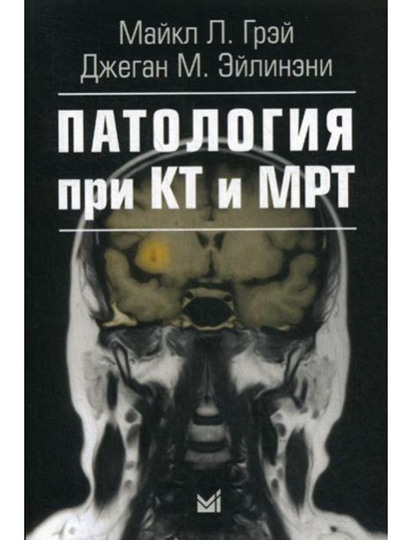 Патология при КТ и МРТ. 2-е изд