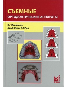 Съемные ортодонтические аппараты. 3-е изд