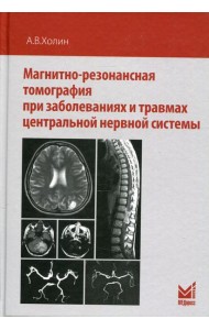 Магнитно-резонансная томография при заболеваниях и травмах центральной нервной системы. 2-е изд